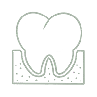 Periodoncia en La Ceja